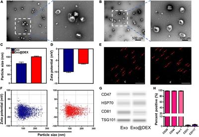 Mesenchymal Stem Cells-Derived Exosomes as Dexamethasone Delivery Vehicles for Autoimmune Hepatitis Therapy